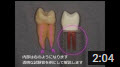 東京で歯の根の治療（根管治療、神経の治療）のおすすめの名医